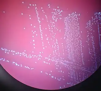 Aerococcus urinae