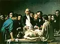 François-Nicolas-Augustin Feyen-Perrin: La Leçon d'anatomie de Velpeau à la Charité (1864)