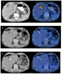 6 transverzálních řezů trupu člověka