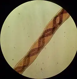 Body of female Angiostrongylus vasorum, detail of white genital strands wrapped around the digestive tract