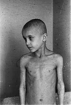 Menno Huizinga: Podvyživený chlapec během Hladové zimy, 1944–1945