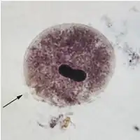 alternativní popis obrázku chybí