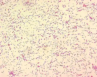 Gramnegativně zbarvené bakterie Brucella spp. pod mikroskopem (velikost bakterií na obrázku je 0,5–0,7 × 0,6–1,5 µm)
