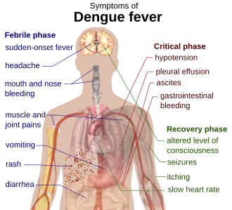 Outline of a human torso with arrows indicating the organs affected in the various stages of dengue fever