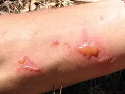 Vliv routy vonné na kůži v horkém počasí.