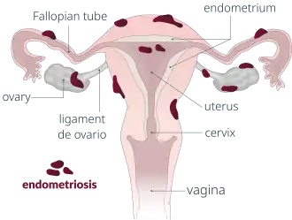 Nejčastější místa výskytu