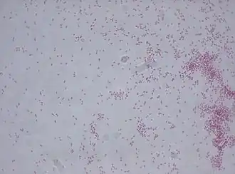 popis obrázku chybí