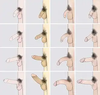 Vznik erekce. Většina mužů má přibližně rovný penis, u cca 20 % je zahnutý vzhůru, u 15 % zahnutý dolů[1]