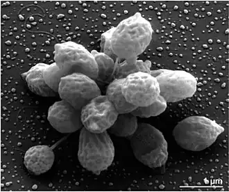 Rubinisphaera brasiliensis