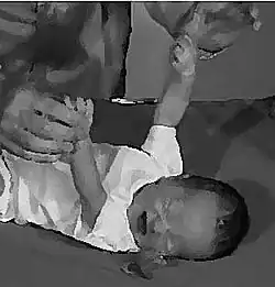 Palmární úchopový reflex