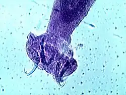 Mikroskopický snímek haptoru žábrohlísta, celý živočich však není vidět. Patrné jsou příchytné struktury (háčky), jimiž se uchycuje na svých hostitelích