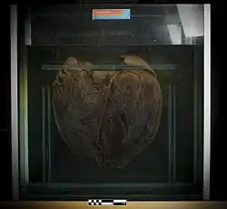 Fotografie muzejního exponátu (mohutné srdce plejtváka preparované ve skleněné nádobě).