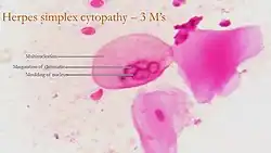 cytopathy