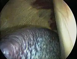 Laparoskopický pohled na slezinu koně