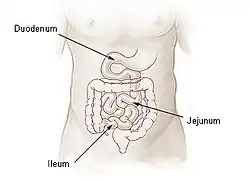 Ileum II