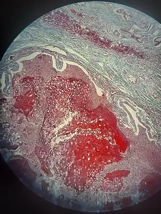 popis obrázku chybí