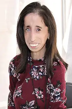 Lizzie Velasquez v roce 2017