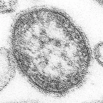 Measles morbillivirus