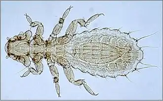 alternativní popis obrázku chybí