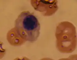 Ortochromní erytroblast