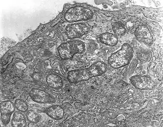 alternativní popis obrázku chybí