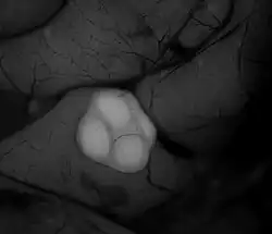 Myší peyerův plát pod stereomikroskopem. Byl použit MHCII-EGFP knock-in myší model, který umožňuje vizualizaci antigen prezentujících buněk pomocí zeleného fluorescenčního proteinu. Z obrázku je patrné, že má kruhový tvar, šířku nepatrně menší než je šířka střeva a vystupuje nad okolní tkáň.