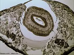 Příčný řez tělem ploštěnky se čtyřicetinásobným zvětšením, na němž je patrná níže popsaná stavba těla. Obrázek nicméně nemá žádné popisky