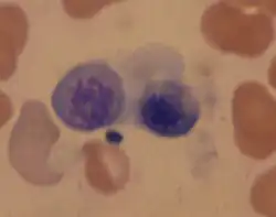 Polychromatofilní erytroblast