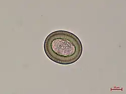 Mikroskopický záběr na vajíčko tasemnice chráněné odolným embryoforem, uvnitř patrná larva onkosféra. Podle doplněného měřítka měří vajíčko asi 40 mikrometrů