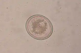 alternativní popis obrázku chybí