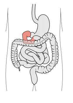 Schematický diagram gastrointektinálního traktu; dvanáctník znázorněn růžově