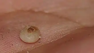 alternativní popis obrázku chybí