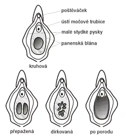 Typy panenských blan