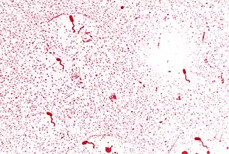 alternativní popis obrázku chybí