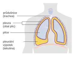 Schéma pleurálního výpotku