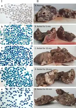 5 mikroskopických snímků vajíček a 5 makroskopických snímků jater